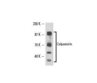 Calpastatin Antibody (PI-11) - Western Blotting - Image 16338 