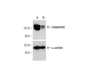 Calpastatin siRNA (h): sc-29889. Western blot analysis of Calpastatin expression in non-transfected control (A) and Calpas 