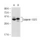 western blotting image from recommended Calponin 1/2/3 (G-10) monoclonal antibody replacement. Image 51933