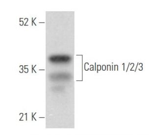 Calponin 1/2/3 Antibody (H-3) - Western Blotting - Image 355478 