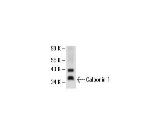 Calponin 1 Antibody (0.N.39) - Western Blotting - Image 17787 