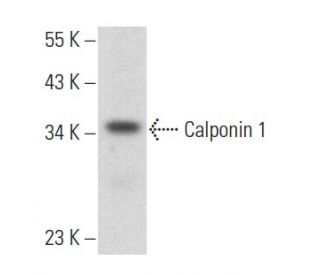 Anti-Calponin 1 Antibody (CALP) | SCBT - Santa Cruz Biotechnology