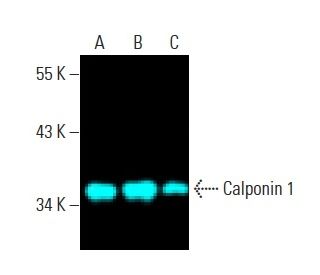 Calponin 1 Antibody (CALP) - Western Blotting - Image 396304