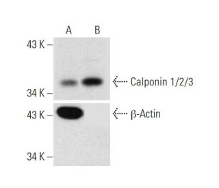 Calponin 1/2/3 Lentiviral Acivation Particles (h): sc-419719-LAC. Western blot analysis of Calponin 1/2/3 expression in no