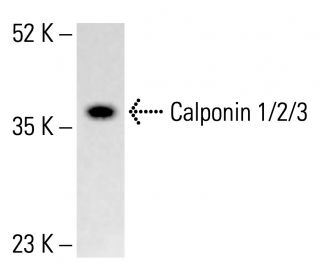Calponin 1/2/3 Antibody (G-10) - Western Blotting - Image 412916