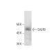 CALR3 Antibody (1H2) - Western Blotting - Image 384451 
