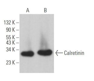 Calretinin Antibody (D-12) - Western Blotting - Image 362925 