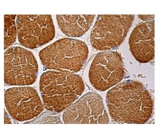 immunohistochemistry image from recommended calsequestrin 1 (D-10) monoclonal antibody replacement. Image 158185