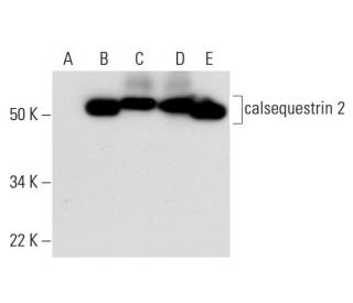 calsequestrin 2 Antibody (E-12) - Western Blotting - Image 291850The Double Nickase Plasmid features a U6 promoter for sgRNA expression, a 20 nt targeting sequence, and a gRNA scaffold to guide Cas9n. It includes a CBh promoter for Cas9n (D10A) and puromycin resistance, GFP for transfection verification, and nuclear localization signals (NLS). The 2A peptide allows co-expression of Cas9n and Puro from a single promoter, enabling precise genome editing with reduced off-target effects.