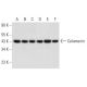 western blotting image from recommended Calumenin (F-8) monoclonal antibody replacement. Image 311941