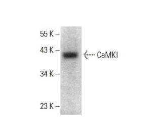 CaMKI Antibody (H-8) - Western Blotting - Image 376334Each CRISPR/Cas9 Knockout (KO) Plasmid product consists of a pool of 3 plasmids designed to ensure identification and cleavage of a specific gene for maximum knockout efficiency. Each plasmid encodes a unique 20 nt sequence derived from the GeCKO (v2) library.