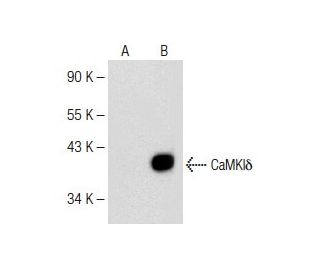 CaMKI&delta; Antibody (C-9) - Western Blotting - Image 147783 