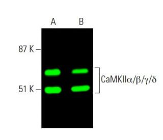 western blotting image from recommended CaMKII (G-1) monoclonal antibody replacement. Image 371788
