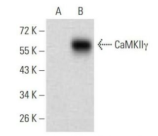 CaMKII gamma Antibody (8G10C1) - Western Blotting - Image 358351
