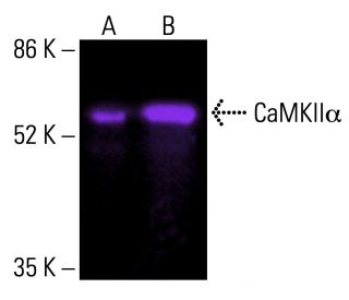 CAMK2A/CaMKII alpha Antibody (6G9) - Western Blotting - Image 415920