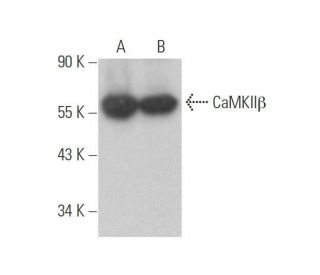 CaMKII&beta; Antibody (D-6) - Western Blotting - Image 352786 