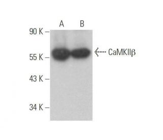 CaMKII beta Antibody (D-6): sc-376828