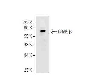 CaMKII&beta; Antibody (K-19) - Western Blotting - Image 82652 