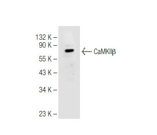 CaMKII beta Antibody (K-19) - Western Blotting - Image 82652 