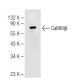 CaMKIIβ Antibody (K-19) - Western Blotting - Image 82652 