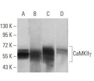 Anti-CaMKII&gamma; Antibody (8G10C1) - Western Blotting - Image 358352 
