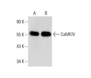 CaMKIV Antibody (A-3) - Western Blotting - Image 73140 