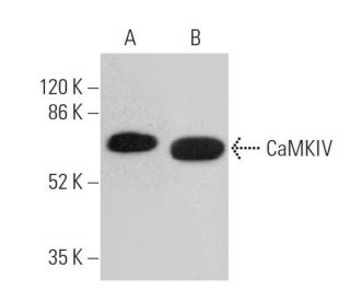 CaMKIV Antibody (A-3) - Western Blotting - Image 359644 