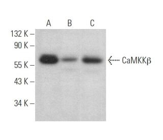 CaMKK&beta; Antibody (C-11) - Western Blotting - Image 375164 