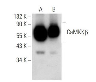 CaMKKβ Antibody (ZZ9) - Western Blotting - Image 74508Each CRISPR/Cas9 Knockout (KO) Plasmid product consists of a pool of 3 plasmids designed to ensure identification and cleavage of a specific gene for maximum knockout efficiency. Each plasmid encodes a unique 20 nt sequence derived from the GeCKO (v2) library.