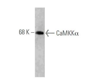 CaMKK&alpha; Antibody (6) - Western Blotting - Image 127468