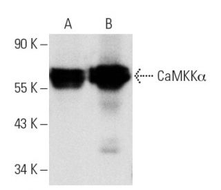 western blotting image from recommended CaMKK&alpha; (F-2) monoclonal antibody replacement. Image 2241