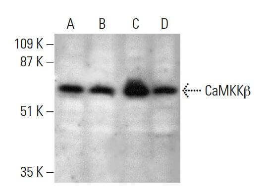 CaMKKβ Antibody (C-11) | SCBT - Santa Cruz Biotechnology