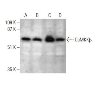 western blotting image from recommended CaMKK&beta; (C-11) monoclonal antibody replacement. Image 386141