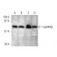 western blotting image from recommended CaMKKβ (C-11) monoclonal antibody replacement. Image 386141