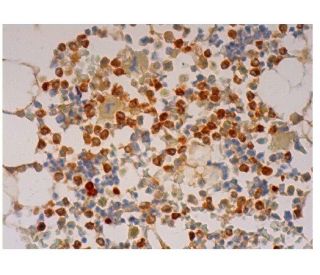 CAP-18 Antibody (H7) - Immunohistochemistry - Image 290520