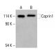Anticorpo anti-Caprin1 (F-3): sc -518251. Analisi mediante Western blot dell'espressione di Caprin1 in lisati di cellule intere di HeLa (A) e di HCT-116 (B). Reagente di rilevamento utilizzato: m-IgG2b BP-HRP: sc-542741. Caprin1 Antibody (F-3) - Western Blotting - Image 416499