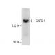 CAPS-1 Antibody (G-12) - Western Blotting - Image 282597 
