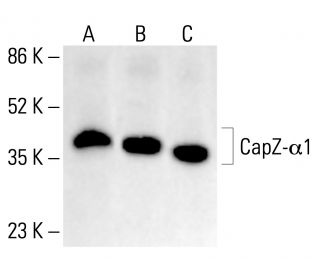 CapZ-&alpha;1 Antibody (2) - Western Blotting - Image 412788 