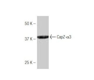 CapZ-&alpha;3 Antibody (MB120) - Western Blotting - Image 53980