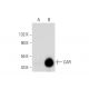 CAR Antibody (A-10) - Western Blotting - Image 145508