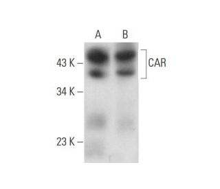 CAR Antibody (A-10) - Western Blotting - Image 300526 