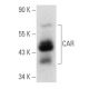 CAR Antibody (A-10) - Western Blotting - Image 354780 