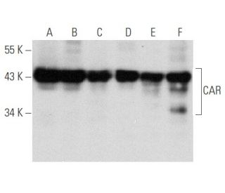 western blotting image from recommended CAR (E-1) monoclonal antibody replacement. Image 354783