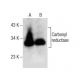 Carbonyl reductase 1/2/3 Antibody (E-5) - Western Blotting - Image 281825
