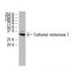 Carbonyl reductase 1 Antibody (Z-8) - Western Blotting - Image 33892 