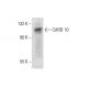 CARD 10 Antibody (B-4) - Western Blotting - Image 137652 