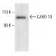 CARD 10 Antibody (B-4) - Western Blotting - Image 401887