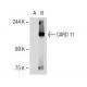 CARD 11 Antibody (A-4) - Western Blotting - Image 113903 