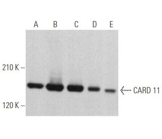 CARD 11 Antibody (A-4) - Western Blotting - Image 363778The Double Nickase Plasmid features a U6 promoter for sgRNA expression, a 20 nt targeting sequence, and a gRNA scaffold to guide Cas9n. It includes a CBh promoter for Cas9n (D10A) and puromycin resistance, GFP for transfection verification, and nuclear localization signals (NLS). The 2A peptide allows co-expression of Cas9n and Puro from a single promoter, enabling precise genome editing with reduced off-target effects. 