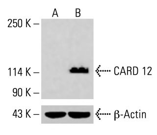 CARD 12 Antibody (F-3) - Western Blotting - Image 415689